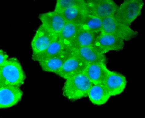 mucin thickness measurement|antibody based mucin testing.